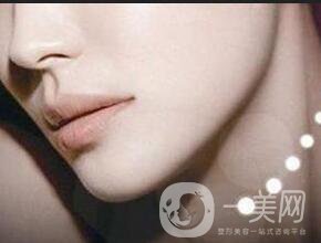 深圳墊下巴費(fèi)用一般是多少？