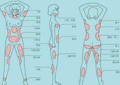 南京吸脂減肥價格是多少？