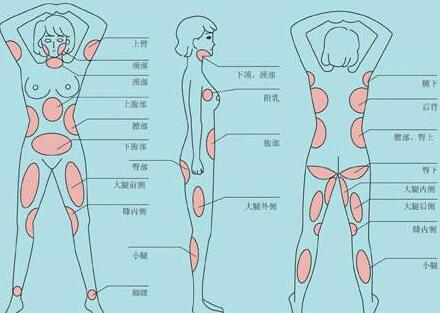 南京吸脂減肥價(jià)格是多少？
