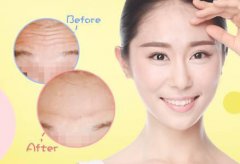 抬頭紋怎么調(diào)節(jié)？調(diào)節(jié)抬頭紋方法有哪些？