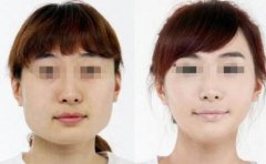 *的價(jià)格是多少