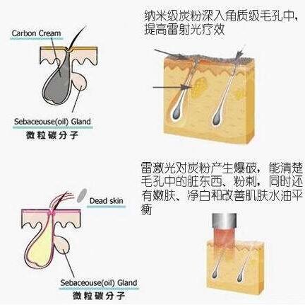 做黑臉娃娃多少錢(qián) 做黑臉娃娃多少錢(qián)一次