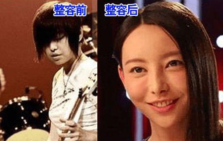 于文文整容了嗎？于文文整容前后圖