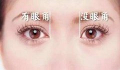 開眼角恢復(fù)時間要多久？多久恢復(fù)自然？