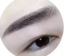 種植眉毛調(diào)節(jié)眉毛缺損手術(shù)是什么？