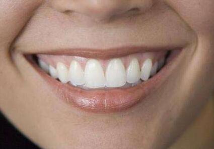 種植牙和烤瓷牙的區(qū)別有哪些？