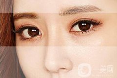 割雙眼皮的價(jià)格貴不貴？多少錢？