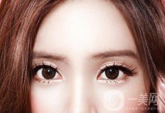 割雙眼皮價格是多少錢？收費明細~