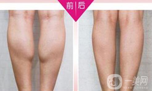 **果好嗎？*多少錢一針？
