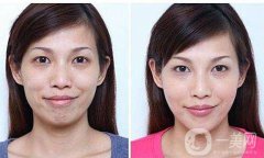 熱瑪吉果好嗎？熱瑪吉除皺果怎么樣？