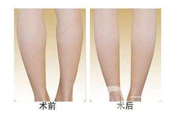 廣州*多少錢