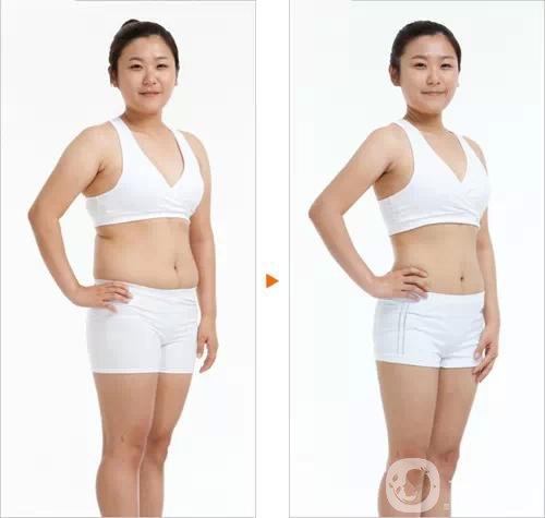 360吸脂減肥多久恢復(fù)正常?要注意些什么？