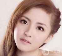 生物焊接雙眼皮價(jià)格一般是多少？