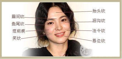 雙美膠原蛋白隆鼻怎么樣?*果能維持多久？