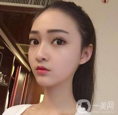 削骨手術(shù)價格 削骨手術(shù)一般多少錢