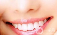 烤瓷牙多久換一次？烤瓷牙如何護理