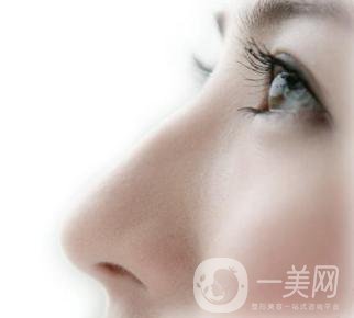 駝峰鼻矯正價錢一般是多少？