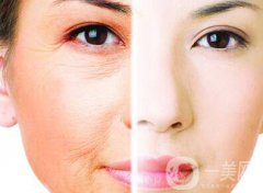 光子嫩膚的果如何、光子嫩膚到底怎么樣？