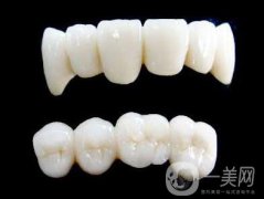 各種烤瓷牙的價格 烤瓷牙多少錢