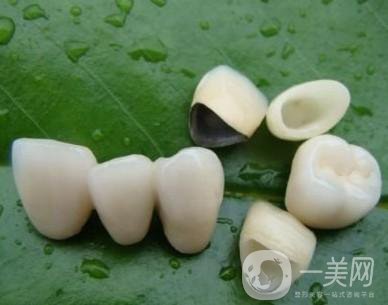 做完烤瓷牙可以使用多少年？