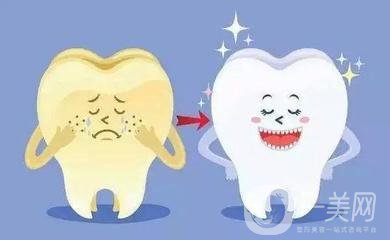 做普通烤瓷牙一般需要多少錢？