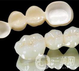 做普通烤瓷牙一般需要多少錢？