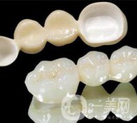 美容冠多少錢 價(jià)格詳情介紹
