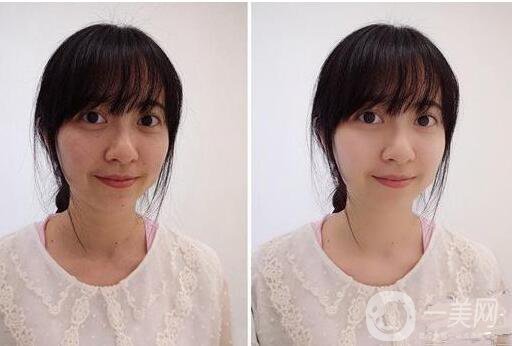 彩光嫩膚