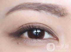 上海割雙眼皮要多少錢(qián) 上海割雙眼皮價(jià)格