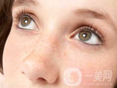 黃褐斑怎么形成的 怎么去除？