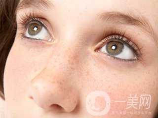 黃褐斑怎么形成的 怎么去除？