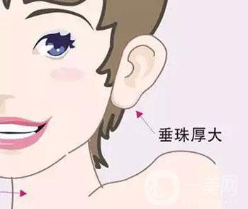注射玻尿酸豐耳垂*果怎么樣？
