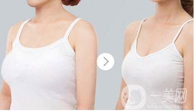 巨乳縮小
