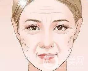 為什么會長老年斑，和哪些因素有關(guān)？