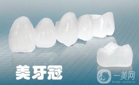 美容冠,多少錢