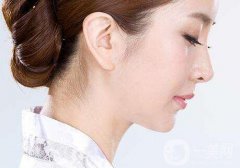隆鼻危險(xiǎn)嗎?隆鼻危險(xiǎn)大嗎？