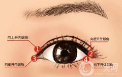 什么人適合做開(kāi)眼角手術(shù)？