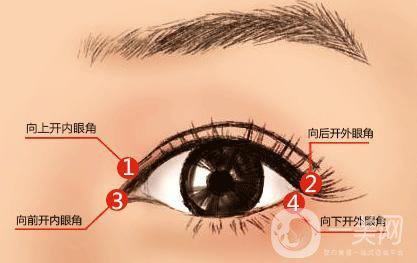 什么人適合做開眼角手術(shù)？