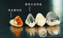 上海鈷鉻烤瓷牙價(jià)格 鈷鉻烤瓷牙要多少錢