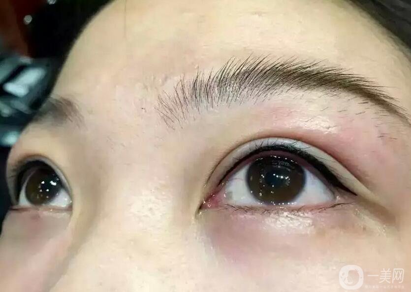 洗眼線多少錢(qián) 洗眼線具體價(jià)格多少