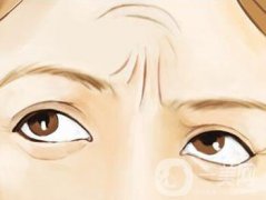 抬頭紋怎么治 去抬頭紋方法一覽