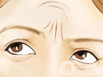 怎么去抬頭紋比較*果？