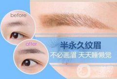繡眉需要多少錢 繡眉的價格是多少