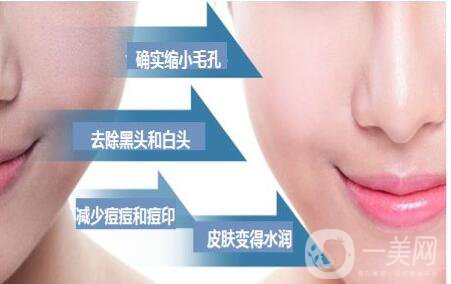 黑臉娃娃