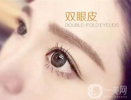 北京割雙眼皮手術多少錢？價格是多少？