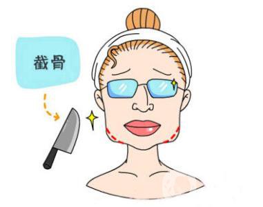 下頜角截骨手術(shù)頭套戴多久 恢復(fù)期要多久？
