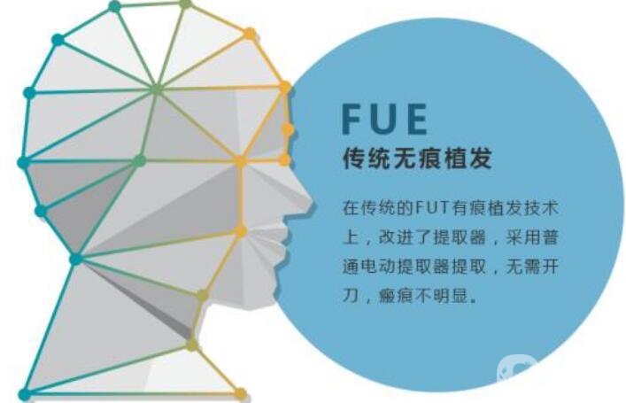 fue植發(fā)技術(shù),*果