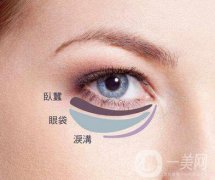 吸脂去下眼瞼眼袋怎么樣？