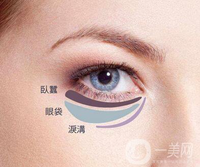 吸脂去下眼瞼眼袋怎么樣？