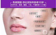 激光祛斑的危害與果分別有哪些？